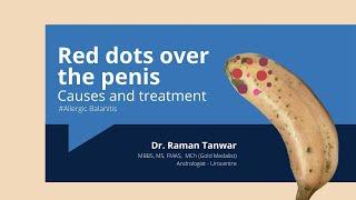 Red dots over the penis: Allergic Balanitis causes and treatment