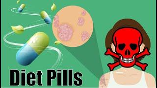 7 Dangers of Weight Loss Pills/ Side Effects of Diet Pills