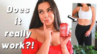 A Nurse’s Review on GOLI Apple Cider Vinegar Gummies // Weight Loss & Clear Skin?!