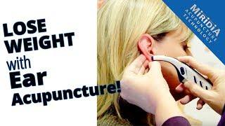 Ear Acupuncture for Weight Loss