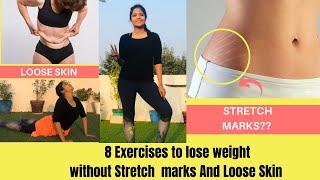 8 Exercises to Lose Weight WITHOUT LOOSE SKIN & STRETCH MARKS After Weight Loss   | Somya Luhadia