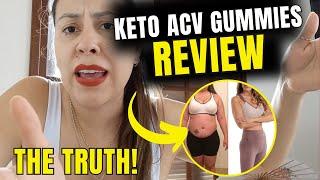 KETOLABS KETO + ACV GUMMIES ((THE TRUTH!))- KETOLABS KETO ACV GUMMIES REVIEW - KETO ACV GUMMIES