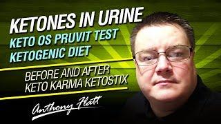 Ketones in Urine keto os pruvit test ketogenic diet before and after keto karma  ketostix