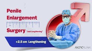 Penile Enlargement Surgery "Just Lengthening" (+2.5 cm lengthening) - Dr. Evren ISIK