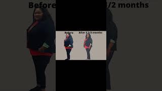 Ozempic Weight Loss Before and After