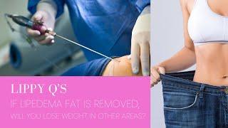 Lippy Q 's | Episode 4: Losing Weight in Other Areas After Lipedema Surgery | Dr. David Amron