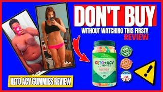 Transform You Life With Keto Acv Gummies My Amazing Weight Loss Journey & Honest Review – Must Watch