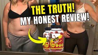 KETO BURN GUMMIES REVIEWS  ✅(THE WHOLE TRUTH)✅ DOES KETO BURN GUMMIES WORK? KETO BURN GUMMIES REVIEW