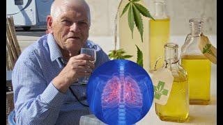 Lung cancer patient SHRUNK tumour ‘using cannabidiol CBD oil’